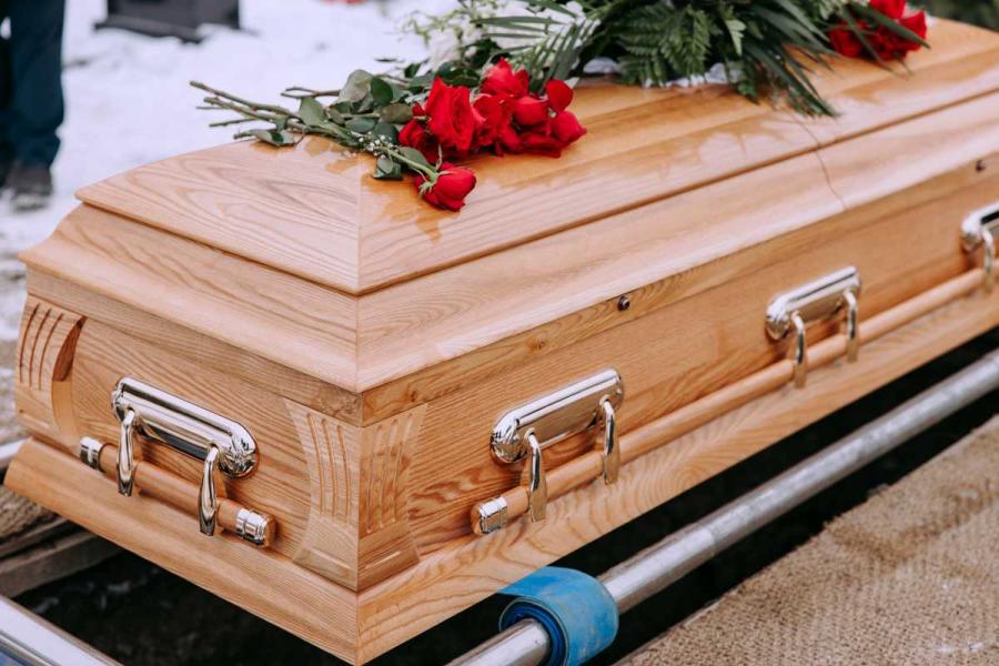 tanatopraxia antes despues